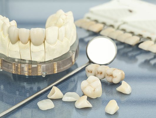 Возможности современной стоматологии — виниры, люминиры, элайнеры